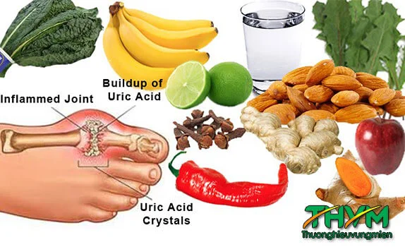 Bệnh gút kiêng ăn gì
